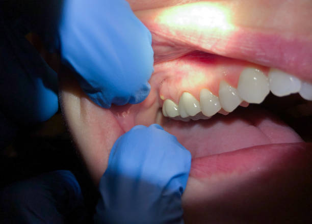 Best Urgent Care for Lost Fillings or Crowns in Heyworth, IL